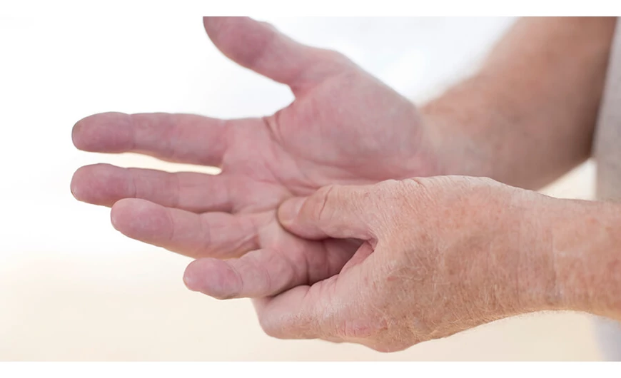 Az arthritis suppurativa vagyis a gennyes ízületi gyulladás bemutatása