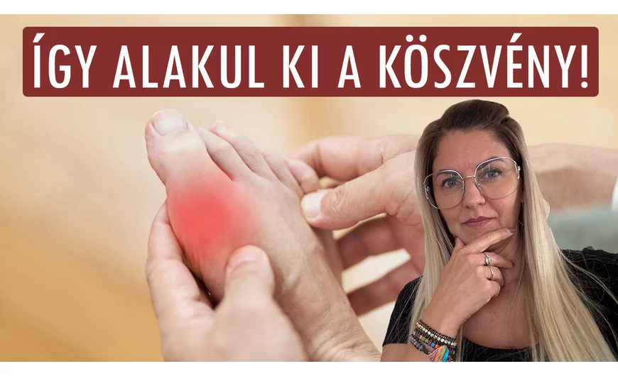 Így alakul ki a fájdalmas ízületek egyik oka: a köszvény!