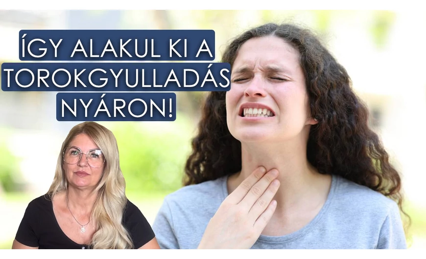 Így alakul ki a torokgyulladás nyáron!