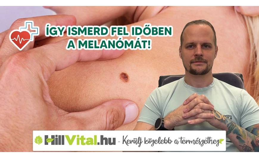 A melanóma tünetei és felismerése