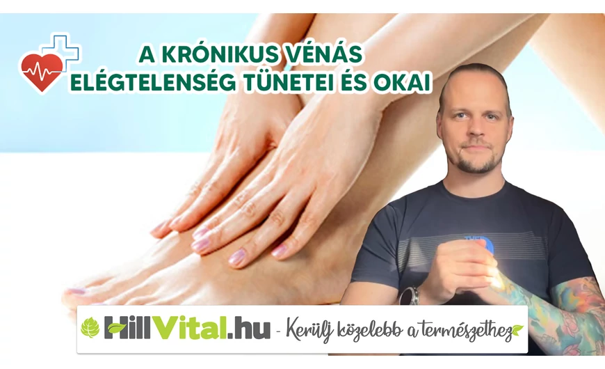 A krónikus vénás elégtelenség tünetei és okai