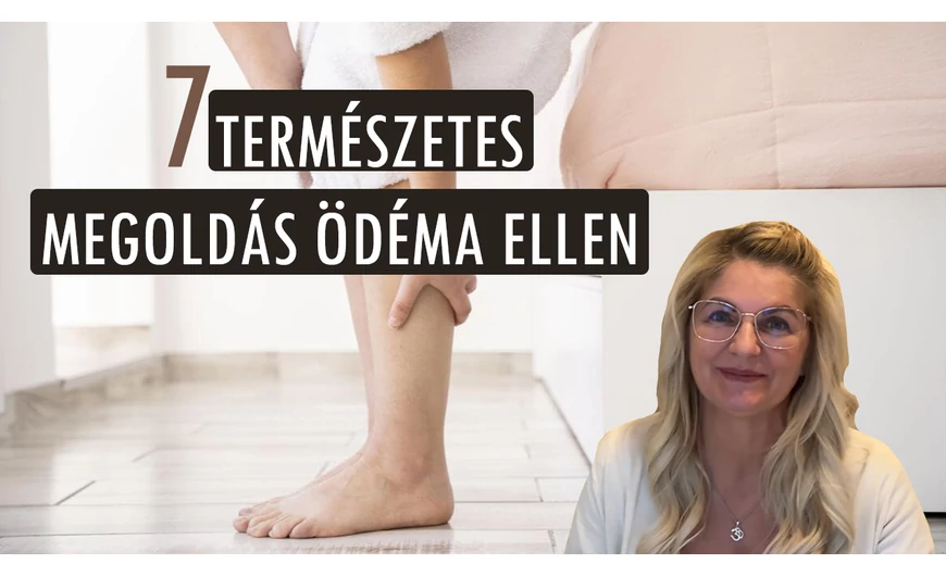 Ödéma STOP! Természetes megoldások a vizesedés ellen