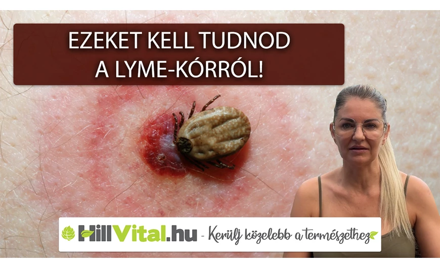 Minden amit tudnod kell a Lyme-kórról