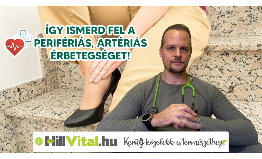 Így ismerd fel a perifériás, artériás érbetegséget!