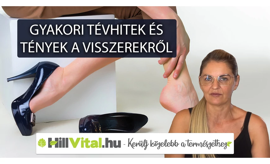 Tények és gyakori tévhitek a visszerekről 