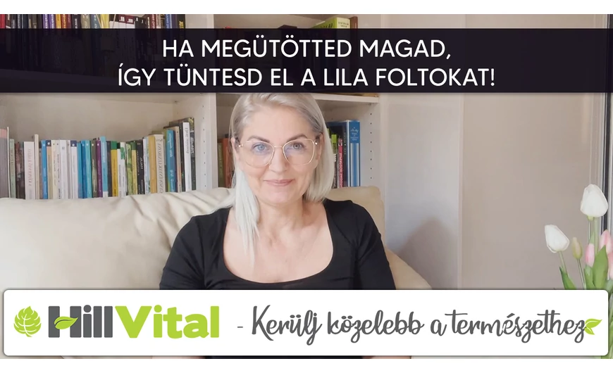 Ha megütötted magad, így tüntesd el a lila foltokat