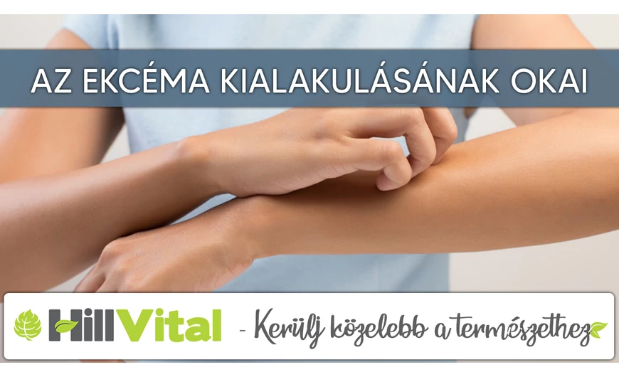 Az ekcéma kialakulásának okai