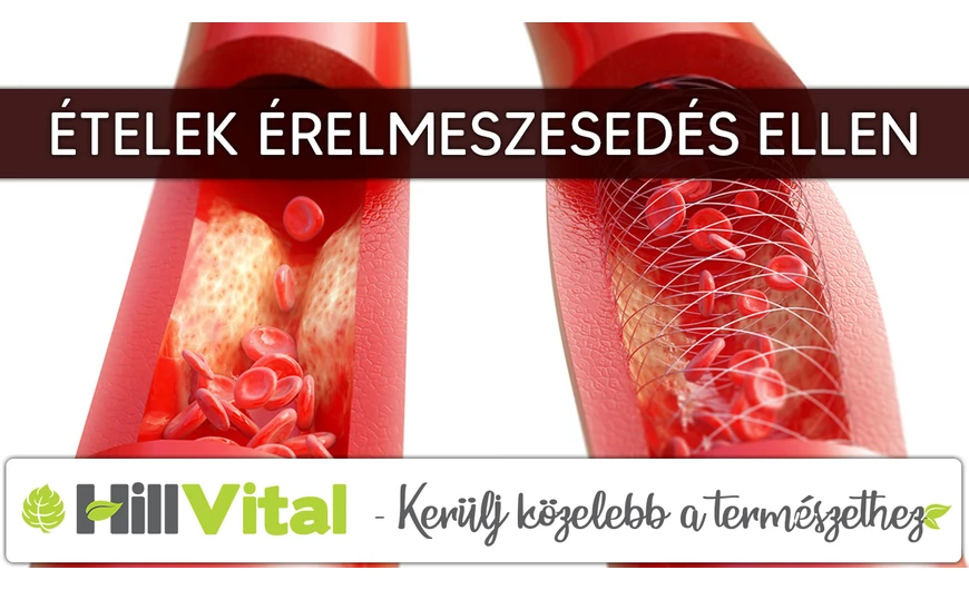 Ételek érelmeszesedés ellen