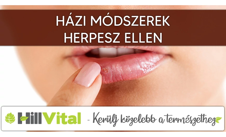 Házi módszerek herpesz ellen