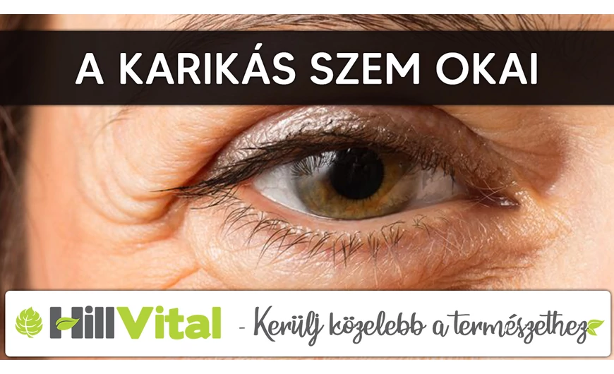 A karikás szem lehetséges okai