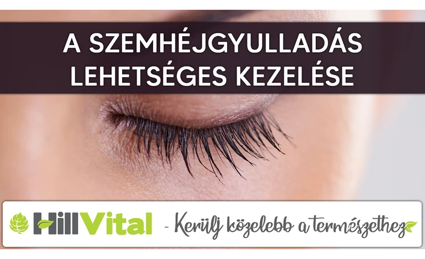 A szemhéjgyulladás természetes kezelése