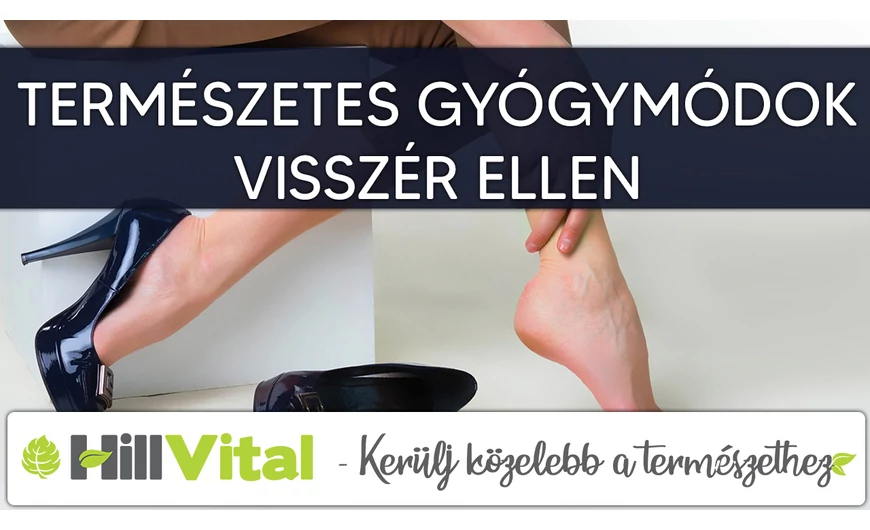 Természetes gyógymódok visszér ellen