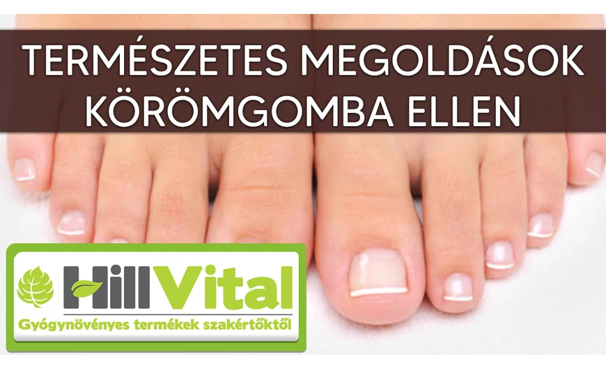 Természetes és hatásos megoldások körömgombára