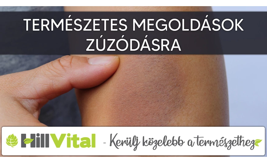 Természetes gyógymódok zúzódások ellen