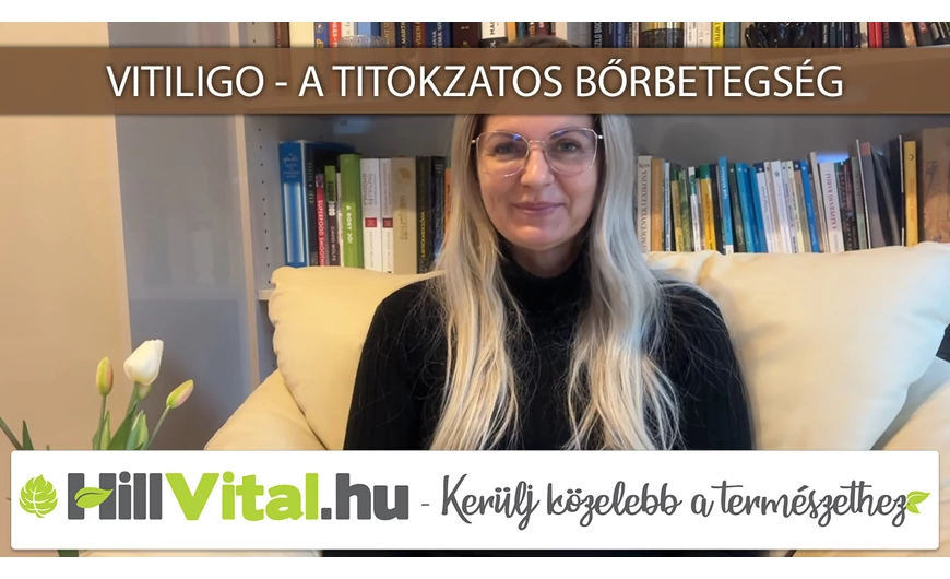A vitiligo tünetei és kezelési lehetőségei