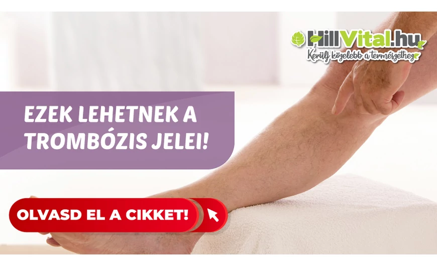 A trombózis jelei: Látható tünetek képekkel illusztrálva